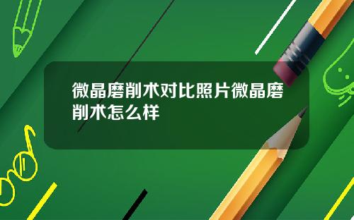 微晶磨削术对比照片微晶磨削术怎么样
