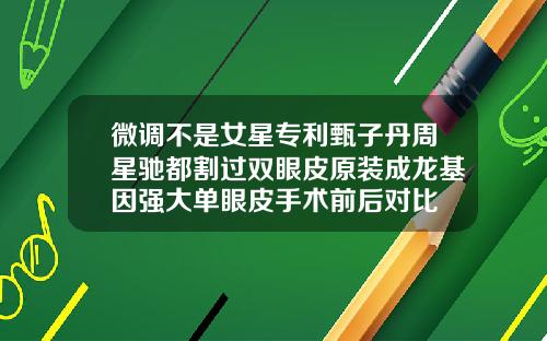 微调不是女星专利甄子丹周星驰都割过双眼皮原装成龙基因强大单眼皮手术前后对比
